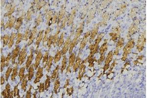 ABIN6273593 at 1/100 staining Human gastric tissue by IHC-P.