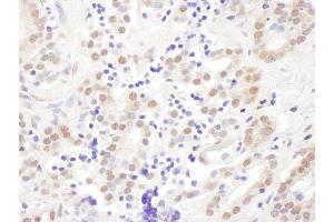 Immunohistochemistry (IHC) image for anti-Exosome Component 10 (EXOSC10) (AA 200-250) antibody (ABIN7454996) (EXOSC10 Antikörper  (AA 200-250))