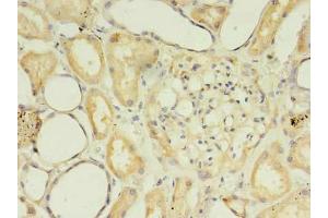 Immunohistochemistry of paraffin-embedded human kidney tissue using ABIN7169587 at dilution of 1:100 (SFXN2 Antikörper  (AA 1-99))