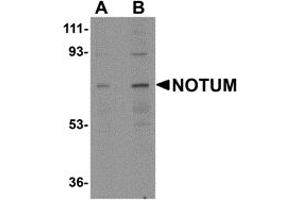 Western Blotting (WB) image for anti-Notum Pectinacetylesterase Homolog (NOTUM) (N-Term) antibody (ABIN1031488) (NOTUM Antikörper  (N-Term))