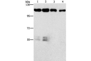 Western Blot analysis of Hela and hepG2 cell, lovo cell and Human colon cancer tissue using CDK11B Polyclonal Antibody at dilution of 1:750 (CDK11 Antikörper)