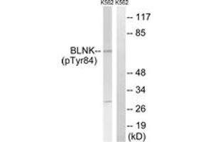 Western blot analysis of extracts from K562 cells treated with starved 24h, using BLNK (Phospho-Tyr84) Antibody.
