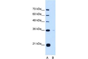 WB Suggested Anti-TOR1B Antibody Titration:  5. (TOR1B Antikörper  (C-Term))