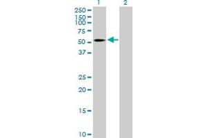 Western Blotting (WB) image for anti-UDP-Gal:betaGlcNAc beta 1,4- Galactosyltransferase, Polypeptide 3 (B4GALT3) (AA 1-393) antibody (ABIN522145)