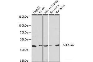 Western blot analysis of extracts of various cell lines using SLC16A7 Polyclonal Antibody at dilution of 1:3000. (SLC16A7 Antikörper)