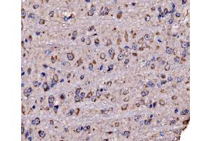 IHC analysis of RPL17 using anti-RPL17 antibody (ABIN7601639). (RPL17 Antikörper  (AA 40-167))