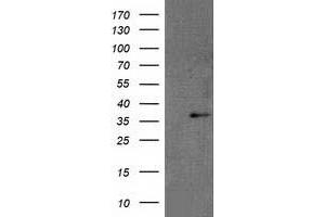 Western Blotting (WB) image for anti-Retinol Dehydrogenase 14 (All-Trans/9-Cis/11-Cis) (RDH14) antibody (ABIN1500655) (RDH14 Antikörper)