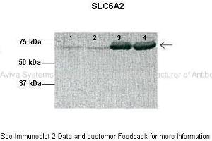 Researcher: Lesie Sheiton, Physiological Sciences GIDP, University of Arizona. (SLC6A2 Antikörper  (Middle Region))
