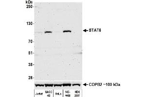 Western Blotting (WB) image for anti-Signal Transducer and Activator of Transcription 6, Interleukin-4 Induced (STAT6) (AA 600-650) antibody (ABIN7453987)