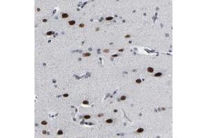Immunohistochemical staining of human cerebral cortex with FAM180A polyclonal antibody  shows strong nuclear positivity in neuronal cells at 1:20-1:50 dilution. (FAM180A Antikörper)
