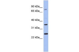 WB Suggested Anti-ZNF133 Antibody Titration:  0. (ZNF133 Antikörper  (N-Term))