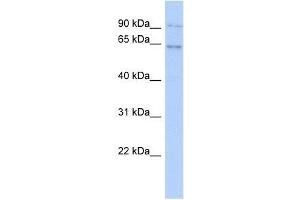 ZNF319 antibody used at 0. (ZNF319 Antikörper  (N-Term))