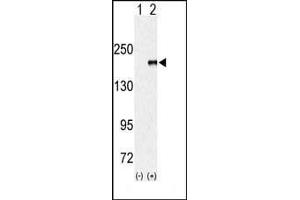 Western blot analysis of EUHMTASE (arrow) using rabbit polyclonal EHMT1 (EUHMTASE1) Antibody (Center) (ABIN387926 and ABIN2844398). (EHMT1 Antikörper  (AA 979-1010))