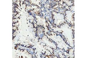 IHC analysis of MUT using anti-MUT antibody (ABIN4886676).