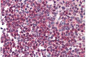 Human Spleen (formalin-fixed, paraffin-embedded) stained with HTRA2 antibody ABIN214496 at 5 ug/ml followed by biotinylated goat anti-rabbit IgG secondary antibody ABIN481713, alkaline phosphatase-streptavidin and chromogen.