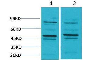 Western Blotting (WB) image for anti-Bestrophin 2 (BEST2) antibody (ABIN3181534) (Bestrophin 2 Antikörper)