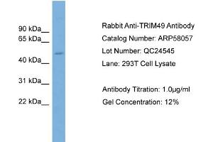 WB Suggested Anti-TRIM49  Antibody Titration: 0. (TRIM49 Antikörper  (Middle Region))