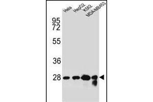 CHPT1 Antibody (N-term) (ABIN654145 and ABIN2844012) western blot analysis in Hela,HepG2,K562,MDA-M cell line lysates (35 μg/lane). (CHPT1 Antikörper  (N-Term))