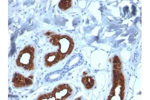 Immunohistochemistry (IHC) image for anti-Keratin 3 (KRT3) antibody (ABIN6939862)