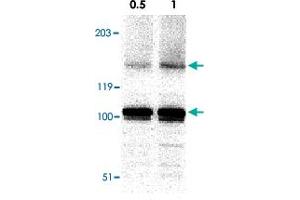 Western blot analysis of IKBKAP in A-20 cell lysate with IKBKAP polyclonal antibody  at in 0.
