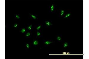 Immunofluorescence of purified MaxPab antibody to XAGE2 on HeLa cell. (XAGE2 Antikörper  (AA 1-111))