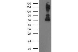 Western Blotting (WB) image for anti-Protein Phosphatase, Mg2+/Mn2+ Dependent, 1B (PPM1B) antibody (ABIN1500374) (PPM1B Antikörper)