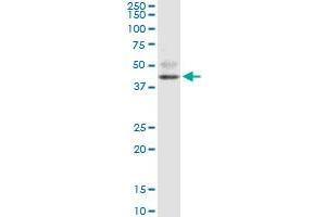 FOXF2 monoclonal antibody (M08), clone 3D11. (FOXF2 Antikörper  (AA 346-443))