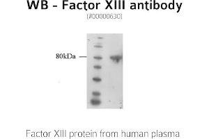 Image no. 1 for anti-Coagulation Factor XIII, A1 Polypeptide (F13A1) antibody (ABIN347012) (F13A1 Antikörper)