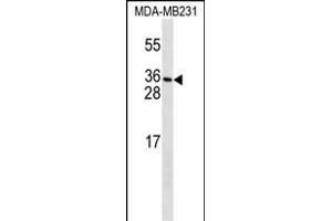 PDGFC Antibody (T89) (ABIN650654 and ABIN2837869) western blot analysis in MDA-M cell line lysates (35 μg/lane). (PDGFC Antikörper  (N-Term))