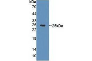 Detection of Recombinant CHRNa4, Human using Polyclonal Antibody to Cholinergic Receptor, Nicotinic, Alpha 4 (CHRNa4) (CHRNA4 Antikörper  (AA 49-242))
