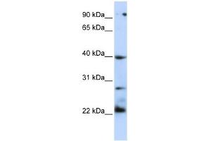 TNFRSF10B antibody (70R-10433) used at 0. (TNFRSF10B Antikörper  (N-Term))