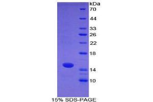 SDS-PAGE (SDS) image for S100 Calcium Binding Protein A7 (S100A7) (AA 1-108) protein (His tag) (ABIN1878099)