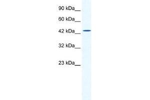 WB Suggested Anti-DMRTB1 Antibody Titration:  2. (DMRTB1 Antikörper  (Middle Region))