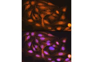 Immunofluorescence analysis of U-2 OS cells using ISG15 Rabbit mAb (ABIN7268023) at dilution of 1:100 (40x lens). (ISG15 Antikörper)