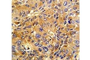 Immunohistochemistry (IHC) image for anti-Cyclin A2 (CCNA2) (AA 51-84) antibody (ABIN3028581)