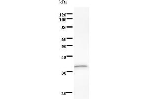 Western Blotting (WB) image for anti-DEAD (Asp-Glu-Ala-Asp) Box Polypeptide 17 (DDX17) antibody (ABIN933152) (DDX17 Antikörper)