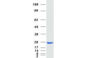 Western Blotting (WB) image for Glutathione S-Transferase alpha 4 (GSTA4) protein (Myc-DYKDDDDK Tag) (ABIN2722273)
