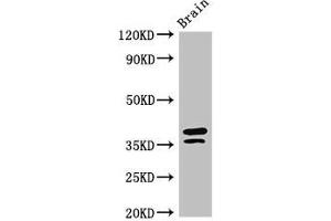 Western Blot Positive WB detected in: Mouse brain tissue All lanes: MAPRE2 antibody at 3 μg/mL Secondary Goat polyclonal to rabbit IgG at 1/50000 dilution Predicted band size: 38, 30, 36, 33, 31 kDa Observed band size: 38, 36 kDa (MAPRE2 Antikörper  (AA 159-240))