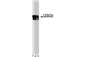 Western blot analysis of p130 [Cas] on a human endothelial cell lysate. (BCAR1 Antikörper  (AA 644-819))