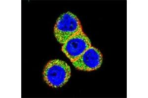 Confocal immunofluorescent analysis of AKT2 antibody with HeLa cells followed by Alexa Fluor 488-conjugated goat anti-rabbit lgG (green). (AKT2 Antikörper  (AA 93-123))