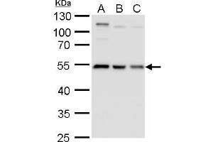 WB Image beta Tubulin 2 antibody detects beta Tubulin 2 protein by western blot analysis. (TUBB2A Antikörper)