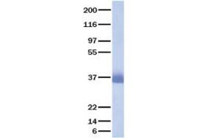 Validation with Western Blot (SFRP1 Protein)