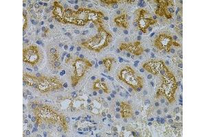 Immunohistochemistry of paraffin-embedded Mouse kidney using ERBB3 Polyclonal Antibody at dilution of 1:100 (40x lens).