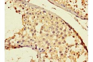 Immunohistochemistry of paraffin-embedded human testis tissue using ABIN7172144 at dilution of 1:100 (THADA Antikörper  (AA 432-651))