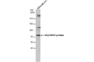 WB Image Alkyl-DHAP synthase antibody detects Alkyl-DHAP synthase protein by Western blot analysis. (AGPS Antikörper)