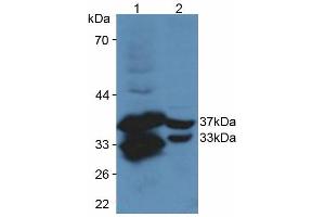 Figure. (CYR61 Antikörper  (AA 176-379))