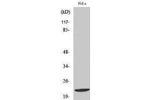 Western Blotting (WB) image for anti-DIRAS Family, GTP-Binding RAS-Like 1 (DIRAS1) (C-Term) antibody (ABIN3184311)