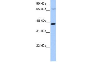 WB Suggested Anti-HMBS Antibody Titration: 0. (HMBS Antikörper  (N-Term))