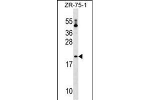 PTRH1 Antibody (Center) (ABIN1537717 and ABIN2849316) western blot analysis in ZR-75-1 cell line lysates (35 μg/lane). (PTRH1 Antikörper  (AA 102-129))