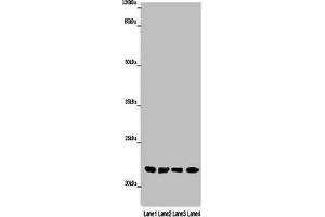 Western blot All lanes: ABHD14B antibody at 16 μg/mL Lane 1: Mouse small intestine tissue Lane 2: Mouse spleen tissue Lane 3: Mouse liver tissue Lane 4: Mouse lung tissue Secondary Goat polyclonal to rabbit IgG at 1/10000 dilution Predicted band size: 23, 19 kDa Observed band size: 23 kDa (ABHD14B Antikörper  (AA 2-210))